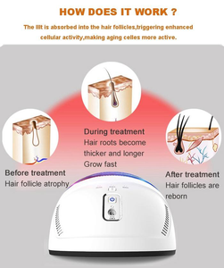 Kernel USA(510K) 650nm Diodo láser LLLT Máquina de crecimiento de cabello para <span class=keywords><strong>la</strong></span> pérdida de cabello Tratamiento de calvicie de <span class=keywords><strong>alopecia</strong></span> - Product Image 6