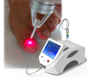 Podologi frekuensi tinggi podiatri dioe perangkat laser 980nm 47w untuk onychomycosis jamur infeksi jamur jamur kuku menghilangkan - Product Image 1