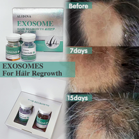 Sérum Capillaire Anti-Chute à Base de Peptides et Cellules Souches, Extrait Végétal, Facteur de Croissance EGF, Kit de Soin du Cuir Chevelu pour la Repousse des Cheveux et la Réparation des Follicules – Usage Professionnel en Salon