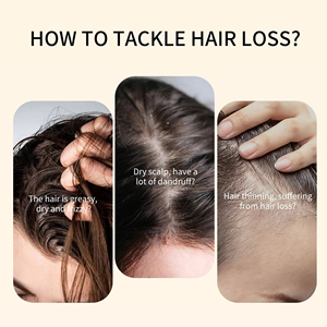 Shampooing et après-shampooing naturels à base d'oignon, de romarin et de biotine, <span class=keywords><strong>sans</strong></span> <span class=keywords><strong>sulfate</strong></span>, shampooing à l'huile d'argan pour la croissance des cheveux, OEM - Product Image 3