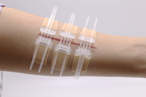 อุปกรณ์ปิดแผลฉุกเฉิน, ชุดเย็บแผลแบบซิป, แผ่นปิดแผลแบบซิปเย็บแผล - Product Image 4