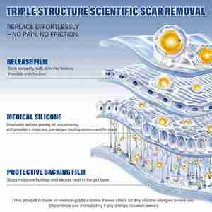 แผ่นซิลิโคนปิดแผลเป็น, เทปซิลิโคนปิดแผลเป็น (ขนาด 1.6 นิ้ว x 158 นิ้ว แบบม้วน - 4 เมตร), แผ่นซิลิโคนปิดแผลเป็นสำหรับแผลผ่าตัด, กำจัดเนื้อเยื่อคีลอยด์ - Product Image 6