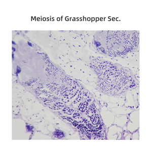 Phân chia tế bào gốc hành tây nguyên phân và nam grasshoper testis meiosis hiển thị tất cả các giai đoạn phân chia trong quần và động vật học - Product Image 6