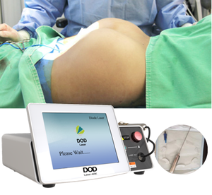 <span class=keywords><strong>Liposucción</strong></span> de relleno a tope 980nm Endolaser Lipólisis Máquina de estiramiento facial Fibra óptica 400um 600um Anti celulitis 1470nm láser - Product Image 1