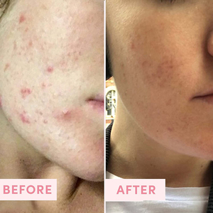 Limpiador de poros faciales, exfoliante <span class=keywords><strong>para</strong></span> la piel, blanqueador de sal Rosa <span class=keywords><strong>Natural</strong></span> orgánica de etiqueta privada, fabricantes de cosméticos - Product Image 5