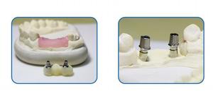 Yucera GSL-5T Fresadora Dental CNC de 5 Ejes, Sistema Abierto 98, para Laboratorio Dental, Funcionamiento en Seco/Húmedo - Product Image 6