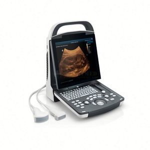 Instrumento de ultrasonido médico DP20 2D Color Doppler Ultrasonido Uso humano Digital <span class=keywords><strong>Mindray</strong></span> BW Ultrasonido - Product Image 1