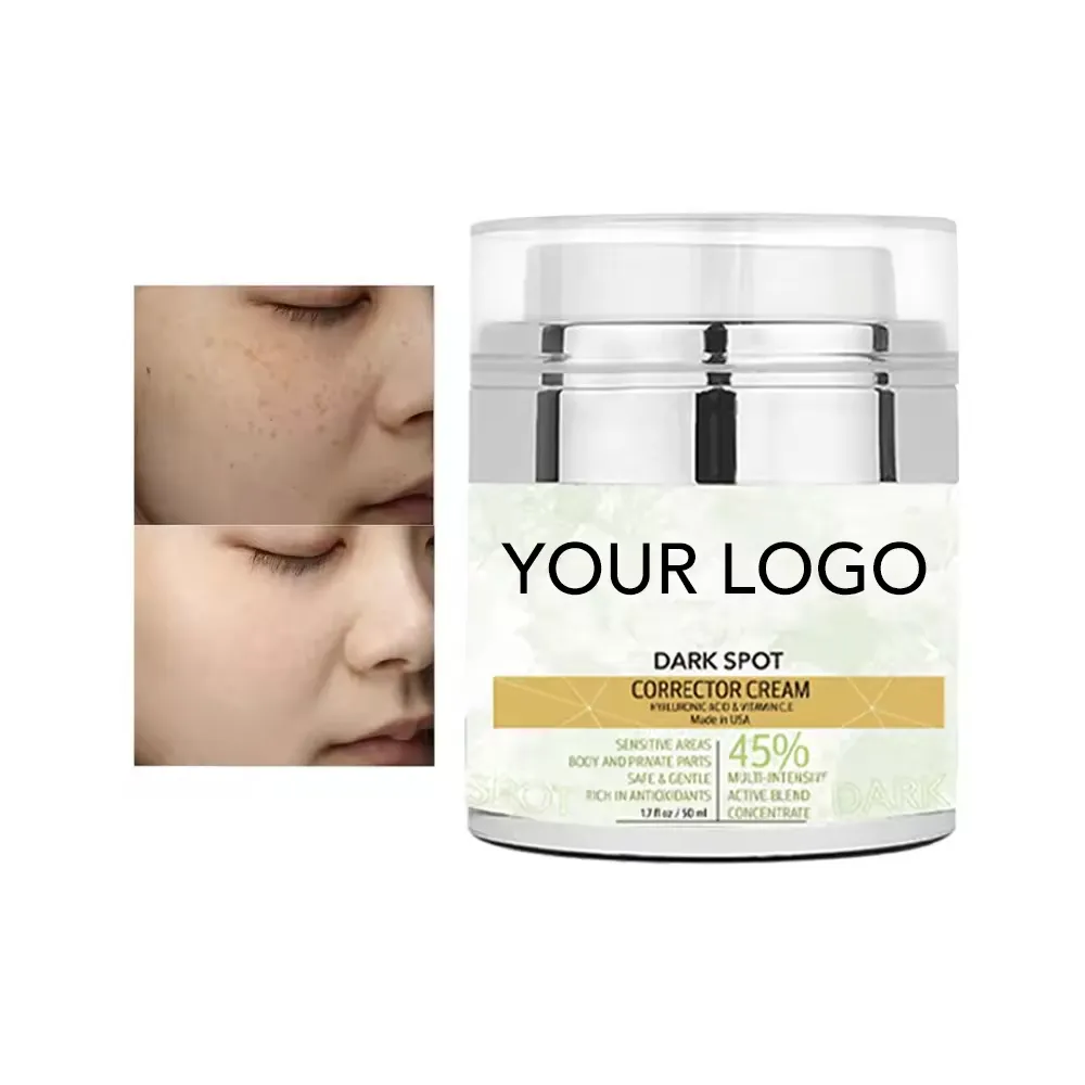 Prate Label Face Crema para eliminar el acné Anti Dark Spot Cream Antienvejecimiento Crema facial blanqueadora fuerte