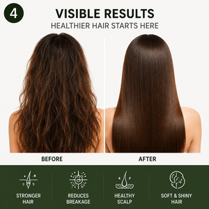 Champú Orgánico <span class=keywords><strong>de</strong></span> Romero <span class=keywords><strong>para</strong></span> Engrosar el Cabello, Fórmula con Queratina Hidrolizada <span class=keywords><strong>para</strong></span> Suavizar y Alisar, <span class=keywords><strong>para</strong></span> Cabello Fino y Caída del Cabello, 100 ml - Product Image 3