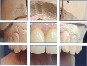 Matériel de laboratoire dentaire en zircone, caméra 3D Plus, plusieurs couches, mm