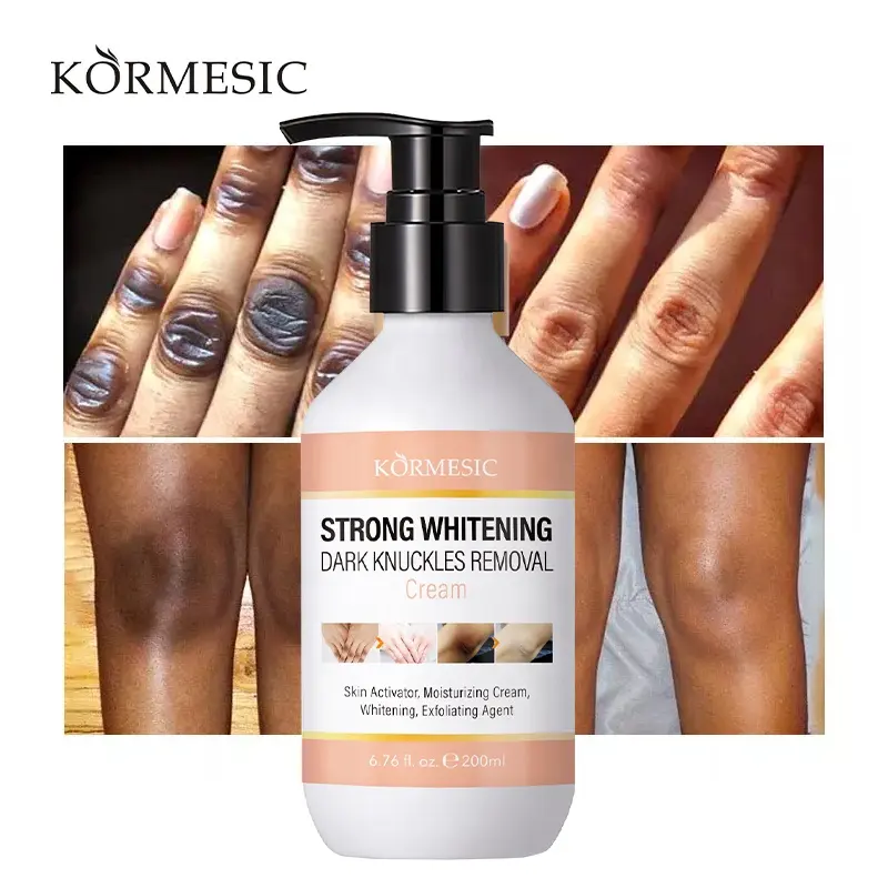 OEM KORMESIC Dark สนับมือและสนับมือ,สนับมือ Dark Spot Eraser ใต้วงแขนข้อศอกรักแร้ไวท์เทนนิ่งครีม