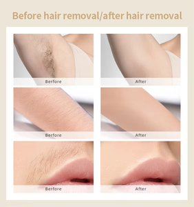 Appareils portables d'épilation, épilateur laser IPL sans douleur, pour le corps, le visage, les jambes, le bikini, les lèvres - Product Image 3