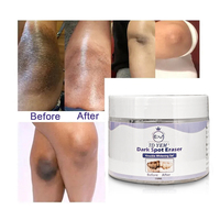 Crème de beauté OEM soins de la peau blanchissant éclaircissant genou aisselles coude élimination des points noirs réduire la mélanine crème de blanchiment des articulations