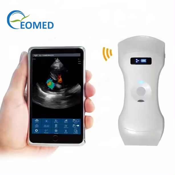 3 in 1 Portable Wireless Ultrasound Probe Type Scanner Ultrasound Device Attractive Price DCU19G