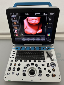 C57 डेस्कटॉप सोसो 4 डी 5 डी अल्ट्रासाउंड उपकरण पूर्ण डिजिटल रंग डॉपलर पोर्टेबल अल्ट्रासाउंड मशीन मानव के लिए - Product Image 6