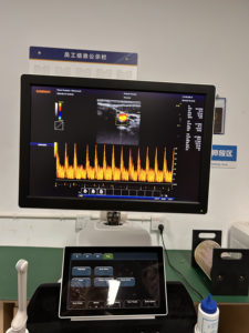 Carro más vendido <span class=keywords><strong>Doppler</strong></span> OB Embarazo 3D/4d Ultrasonido <span class=keywords><strong>Doppler</strong></span> color - Product Image 3