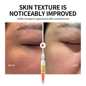 Suero Facial OEM Antiarrugas, Rejuvenecedor y Calmante en Suspensión Oleosa de 30 ml, Monodosis, Mejora la Sensibilidad de la Piel, Reconstruye la Resiliencia - Product Image 4