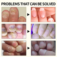 Sérum Traitement Anti-Champignons des Ongles Puissant et Efficace en 7 Jours, Solution Réparatrice et Nourrissante pour Ongles Abîmés Naturels
