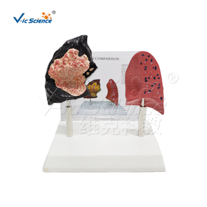 Modèle anatomique médical pour le tabagisme Modèle d'<span class=keywords><strong>anatomie</strong></span> humaine médicale Modèle de comparaison du <span class=keywords><strong>poumon</strong></span> fumeur de <span class=keywords><strong>poumon</strong></span> humain - Product Image 1