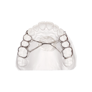 Plaque d'expansion orthodontique dentaire amovible en acrylique avec vis d'expansion - Product Image 4