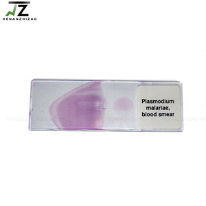 1 parça Plasmodium malariae kan smear parazitoloji slaytlar satış için hazırlanan slaytlar - Product Image 2