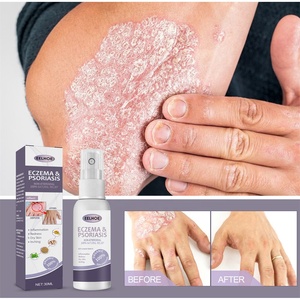 Spray para Eczema y Psoriasis, Spray para <span class=keywords><strong>Manos</strong></span> y Pies, Inflamación <span class=keywords><strong>de</strong></span> la Piel, Enrojecimiento, Picazón, <span class=keywords><strong>Tratamiento</strong></span> para Psoriasis, Eczema y Dermatitis - Product Image 2