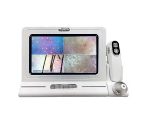 Detector de Análisis Capilar de Cuatro Espectros para Cuero Cabelludo y Piel, Pantalla Grande HD, 200 Aumentos, para Salón de Belleza y Uso Manual en Depilación - Product Image 3