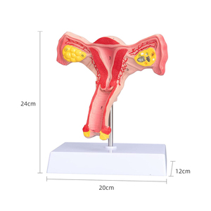 แบบจำลองมดลูกและรังไข่ทั้งสองด้าน แบบจำลองมดลูกหญิง สำหรับสื่อการสอน การเรียนรู้วิทยาศาสตร์การแพทย์ กายวิภาคศาสตร์ แบบจำลองมดลูก - Product Image 3
