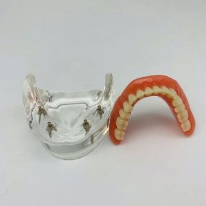 KyrenMed-Localisateur dentaire à quatre implants, modèle de prothèse inférieure, dents amovibles, modèle <span class=keywords><strong>mandibulaire</strong></span> - Product Image 6