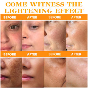 Yeni stil kore OEM/ODM organik hızlı beyazlatma yüz vücut cilt bakımı seti Anti-aging limon seti hyaluronik asit krem Serum güzellik - Product Image 5