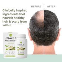 Comprimés naturels à base de plantes pour la repousse des cheveux, renforcement des racines, croissance rapide, complément anti-chute de cheveux