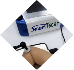 Pabrik Phisioterapi Cet Ret Diathermy Tecar Terapi Rehabilitasi Tubuh/Prapia Tecar Pereda Nyeri Physio Mesin Tecar Pintar - Product Image 5