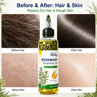 Huile Essentielle de Romarin Pressée à Froid Multi-usages pour la Croissance des Cheveux et les Soins de la Peau 100% Pure Naturelle à Absorption Rapide OEM/ODM Disponible