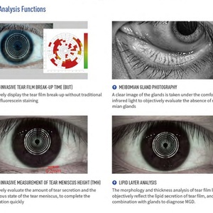 Analyseur de surface oculaire non invasif, analyseur automatique de la sécheresse oculaire pour un examen complet de la sécheresse oculaire DEA60 - Product Image 5