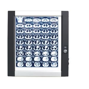 Micare, máquina de visor de película de rayos <span class=keywords><strong>X</strong></span> de bajo precio OEM, panel único de relámpago automático para Hospital, 2017 - Product Image 1