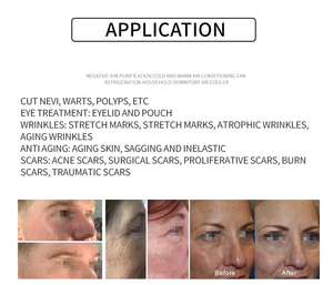Nuevo Lápiz de Plasma Frío y Caliente Mejorado, Portátil, 2 en 1, para Reparación de la Piel del Rostro, Reafirmación, Lifting, Antienvejecimiento, Limpieza y Eliminación de Manchas - Product Image 5
