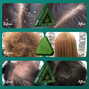 ชุดอาบ<span class=keywords><strong>น้ำ</strong></span>สำหรับผู้<span class=keywords><strong>ชาย</strong></span><span class=keywords><strong>น้ำ</strong></span>มันปลูกผมธรรมชาติ100% บำรุงหนังศีรษะทำด้วยมือสำหรับผู้หญิงผู้ชาย - Product Image 2