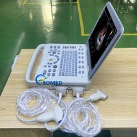 EOMED CU30-2 Nouvelle conception, appareil d'échographie Doppler couleur portable et durable, pour usage vétérinaire et humain, équipement de diagnostic