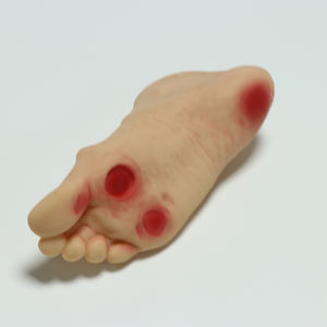 Modelo avanzado de la lesión del pie para diabéticos - Product Image 2