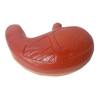 Meilleur prix PVC plastique humain taille naturelle biologie démonstration médicale enseignement anatomique malade ulcère d'estomac modèle d'anatomie
