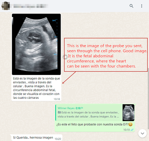 Full Digital Medical Sonda Sem Fio Ultrassom Scanner 3 em 1 Cor Sonda Portátil Doppler Portátil - Product Image 5