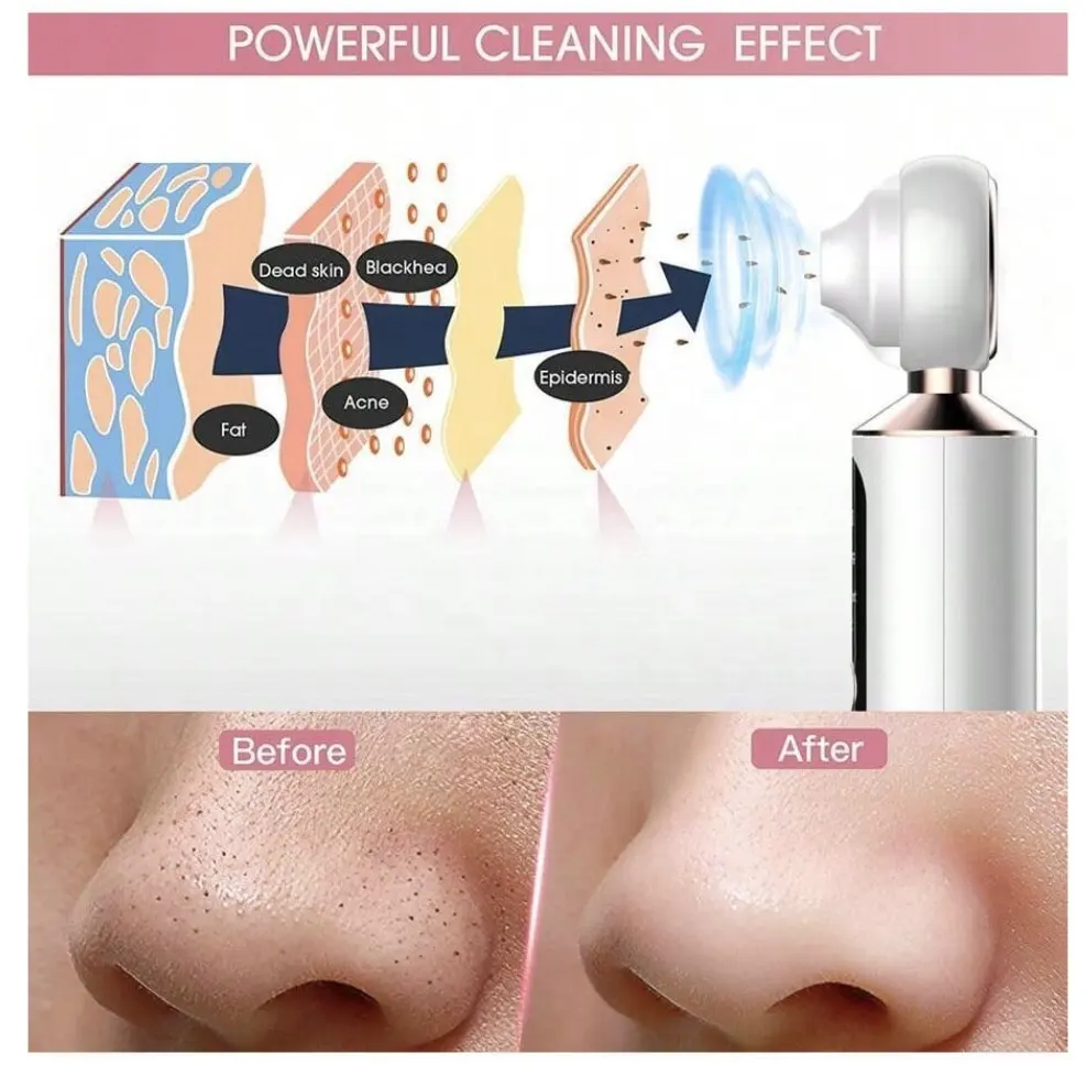 Dispositivo de limpeza facial recarregável para acne facial, removedor de cravos visíveis com luz LED