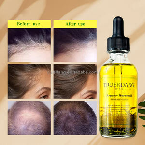 OEM/ODM, aceite orgánico natural de cola de caballo, romero, menta, para el crecimiento del cuero cabelludo, prevención de la pérdida de cabello, aceite para el cuidado del cuero cabelludo - Product Image 3