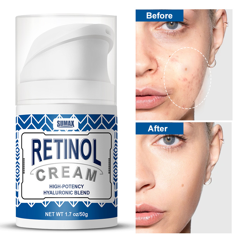 SUMAX Cross-border Export English Packaging Temu Explosions Press Duck Bill Retinol Cream 50ml Whitening Pearl Eye Use 3-Year