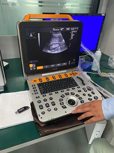 Ecógrafo Doppler Color Portátil de Grado Profesional Dawei DW-P60 con Imágenes de Elastografía para Diagnóstico Veterinario - Product Image 3
