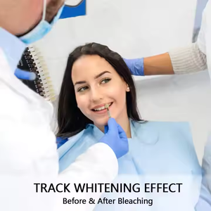 Aprobado por La CE 35% Peróxido <span class=keywords><strong>de</strong></span> hidrógeno Gel blanqueador <span class=keywords><strong>de</strong></span> dientes Jeringa <span class=keywords><strong>de</strong></span> doble barril OEM - Product Image 5