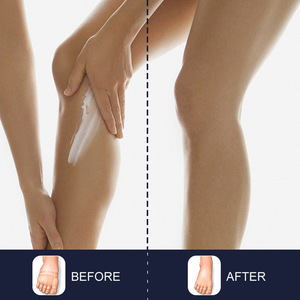 Crema Gel con Erbe Naturali per Alleviare il Gonfiore delle Gambe e Migliorare la Circolazione per il Comfort Quotidiano - Product Image 6