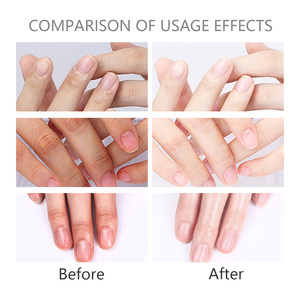 <span class=keywords><strong>Aceite</strong></span> <span class=keywords><strong>para</strong></span> el Cuidado <span class=keywords><strong>de</strong></span> <span class=keywords><strong>Uñas</strong></span> y Cutículas <span class=keywords><strong>de</strong></span> <span class=keywords><strong>Coco</strong></span>, Hidratante, Suavizante <span class=keywords><strong>de</strong></span> Cutículas, Nutritivo, Tratamiento Diario <span class=keywords><strong>para</strong></span> la Reparación <span class=keywords><strong>de</strong></span> la Cama Ungueal - Product Image 5
