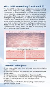 Prix Usine Nouveautés Appareil de Beauté 2-en-1 <span class=keywords><strong>à</strong></span> <span class=keywords><strong>Radiofréquence</strong></span> <span class=keywords><strong>Fractionnée</strong></span> Or pour Raffermissement Cutané, Anti-rides et Lifting Facial, avec Fonction Froid - Product Image 2