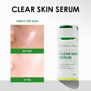 Suero para Piel Clara con Centella Asiática 10 ml - Esencia Facial Calmante para el Cuidado Profesional de las Imperfecciones, para una Tez Equilibrada y Refinada - Product Image 2